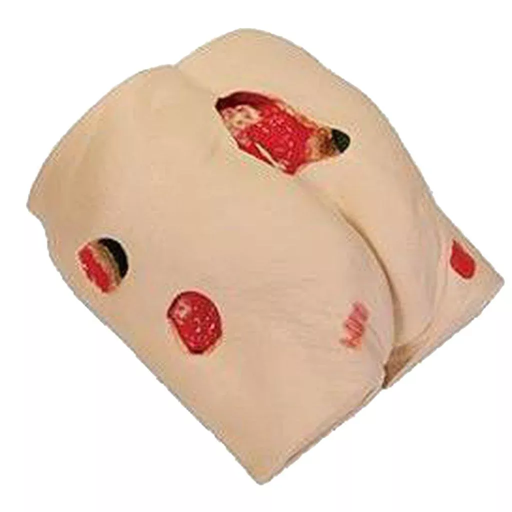 Decubitus Wound Care Model