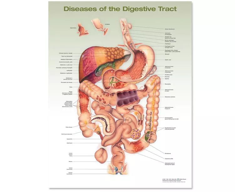 Diseases Of The Digestive System Anatomical Chart