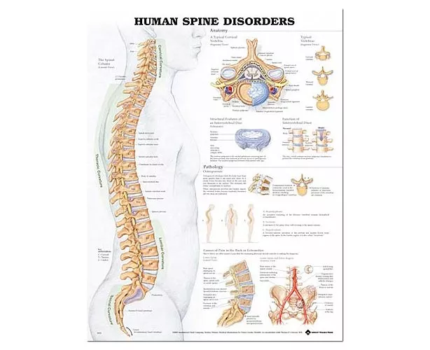 Human Spine Disorders Anatomical Chart