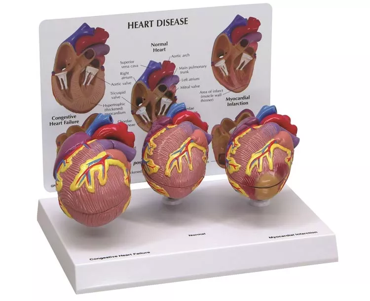Mini Heart Anatomy Models Set - 3 Piece